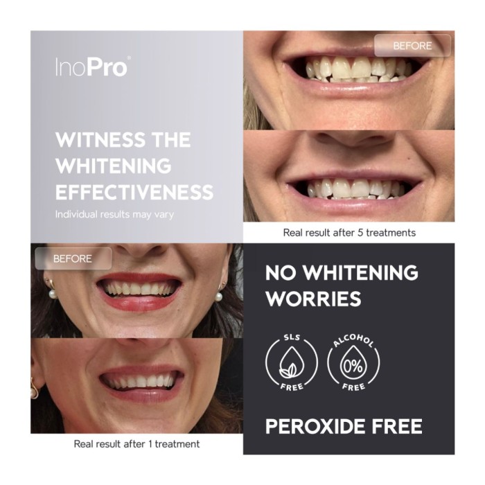 Inopro Advanced Whitening Strips Bromelain - 7 treatments Body