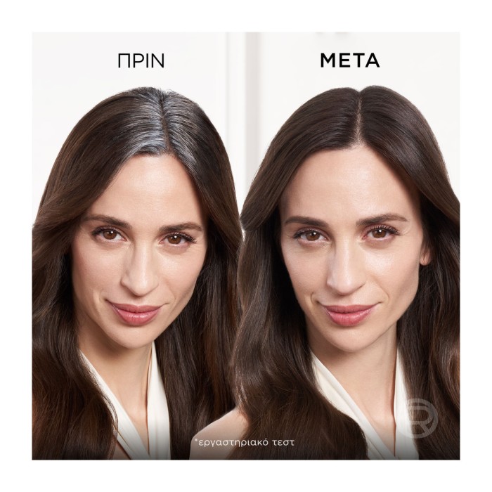 LOreal Paris Magic Retouch - Σπρέι Κάλυψης Λευκών Ριζών 7 Ψυχρό Καστανό, 75ml