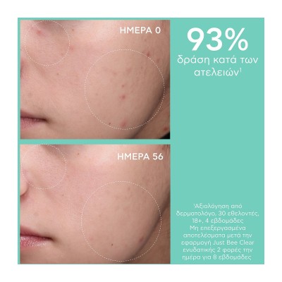 Apivita Just Bee Clear Κρέμα Κατά Των Ατελειών 40ml