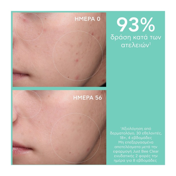 Apivita Just Bee Clear Κρέμα Κατά Των Ατελειών 40ml